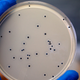 Illustration for article titled Researchers May Have Discovered SuperStaph's Origins